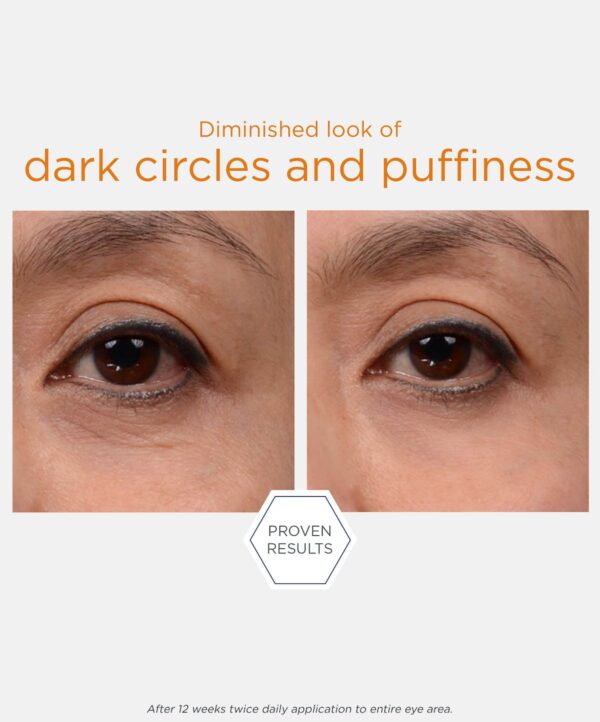 30119_neostrata_brightening_eye_cream_v5.jpg 30119_neostrata_brightening_eye_cream_v5.jpg