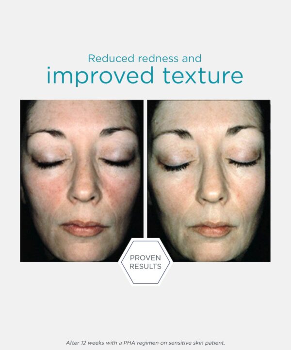 30137_neostrata_bionic_face_cream_v5.jpeg 30137_neostrata_bionic_face_cream_v5.jpeg