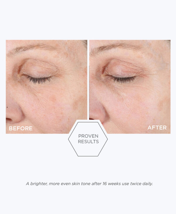 30123_neostrata_ultra_brightening_cleanser_v5.jpg 30123_neostrata_ultra_brightening_cleanser_v5.jpg